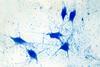 An image showing a light micrograph of human brain tissue showing neurons and glial cells